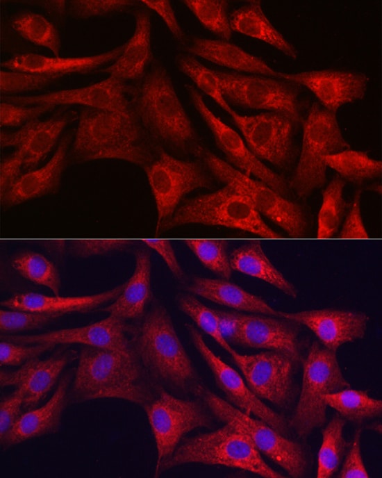 Sirtuin 3/SIRT3 Antibody - Azide and BSA Free