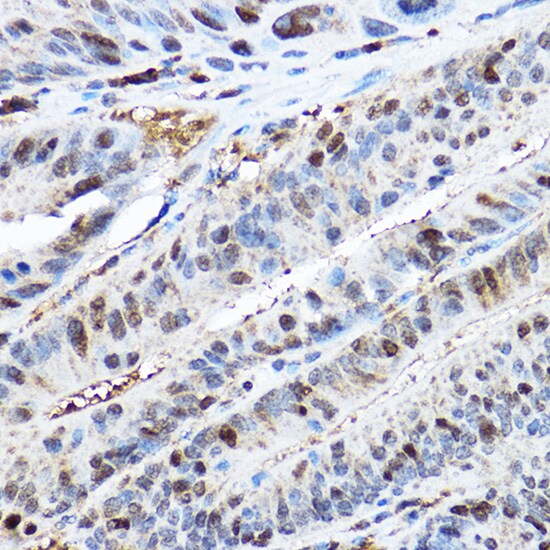 CDK2 Antibody - Azide and BSA Free