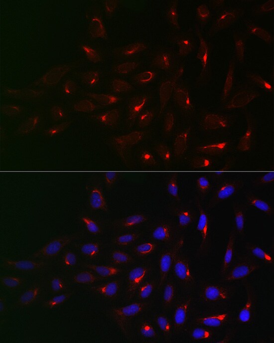 Vimentin Antibody - Azide and BSA Free