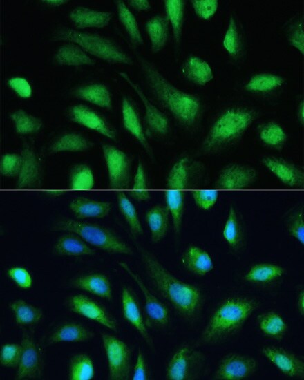 Galectin-3 Antibody - Azide and BSA Free