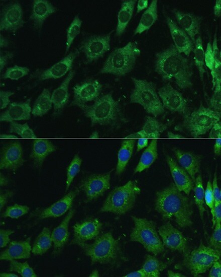 Galectin-3 Antibody - Azide and BSA Free