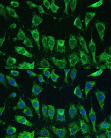 Galectin-3 Antibody - Azide and BSA Free