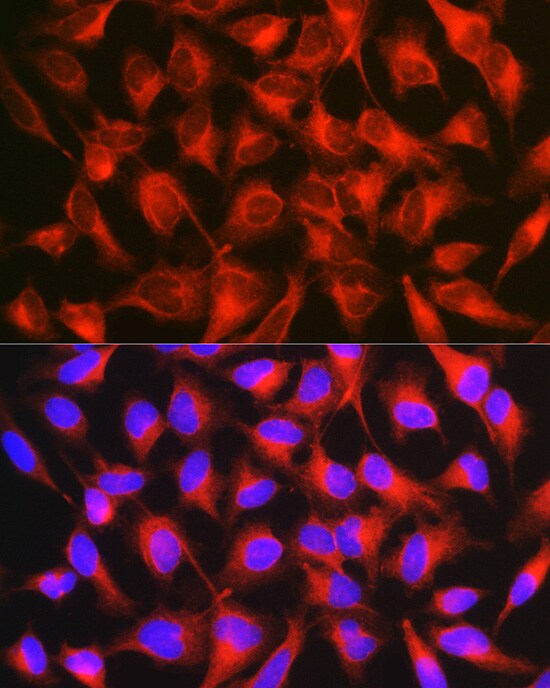L1CAM Antibody - BSA Free