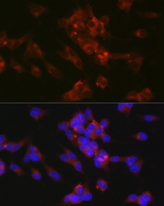 L1CAM Antibody - BSA Free