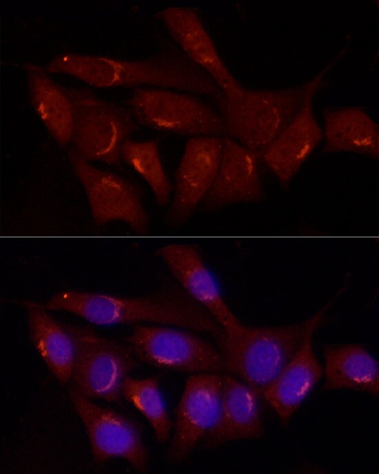 Gastrin-releasing Peptide/Bombesin/Neuromedin C Antibody - BSA Free