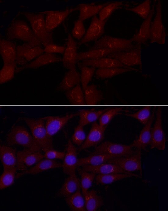 Gastrin-releasing Peptide/Bombesin/Neuromedin C Antibody - BSA Free