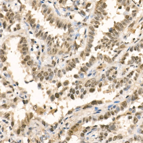 Methyltransferase like 3 Antibody - Azide and BSA Free