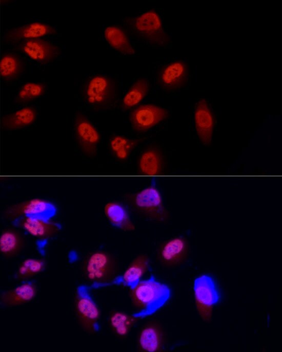 Methyltransferase like 3 Antibody - Azide and BSA Free