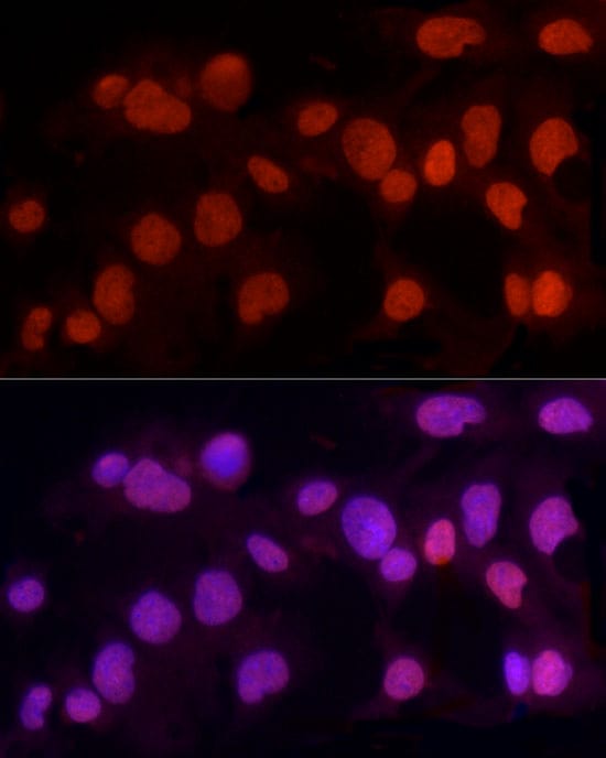 Methyltransferase like 3 Antibody - Azide and BSA Free