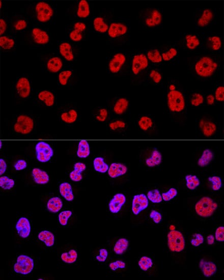 Methyltransferase like 3 Antibody - Azide and BSA Free