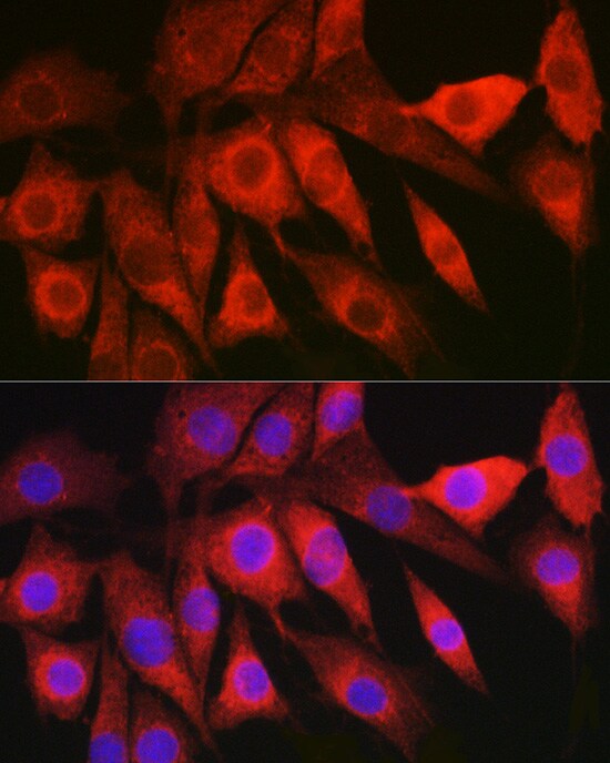 HBXIP Antibody - BSA Free