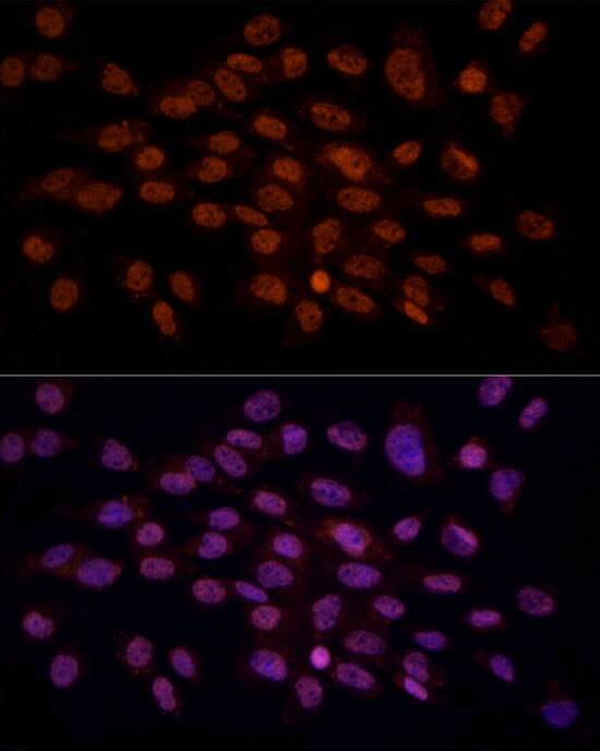 gamma C Crystallin Antibody - BSA Free