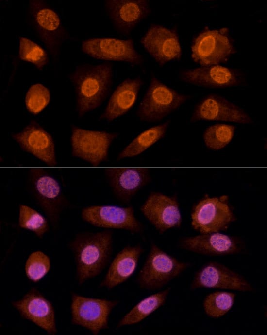 gamma C Crystallin Antibody - BSA Free