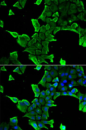 Frequenin Antibody - BSA Free
