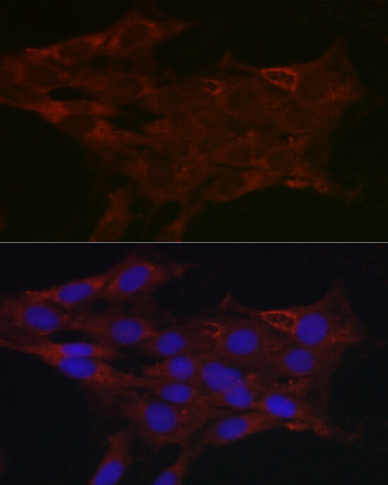 Glucuronosyltransferase 1A1/UGT1A1 Antibody - Azide and BSA Free
