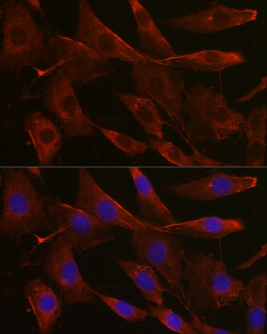 Glucuronosyltransferase 1A1/UGT1A1 Antibody - Azide and BSA Free