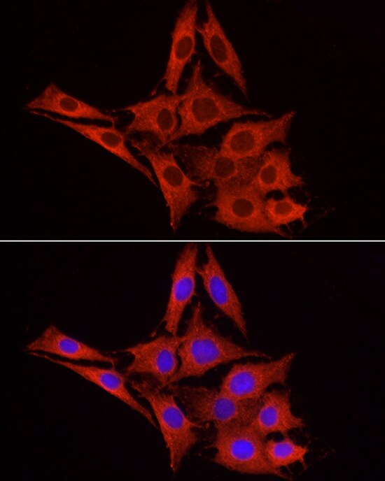 Glucuronosyltransferase 1A1/UGT1A1 Antibody - Azide and BSA Free