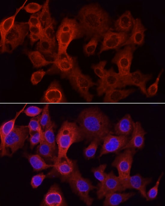 Glucuronosyltransferase 1A1/UGT1A1 Antibody - Azide and BSA Free