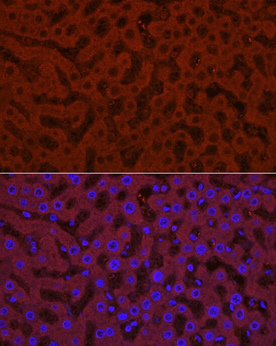 Glucuronosyltransferase 1A1/UGT1A1 Antibody - Azide and BSA Free