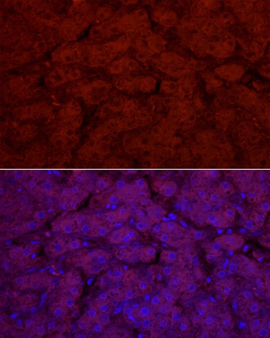 Glucuronosyltransferase 1A1/UGT1A1 Antibody - Azide and BSA Free