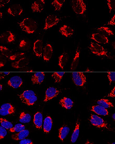 Mitofilin Antibody - BSA Free