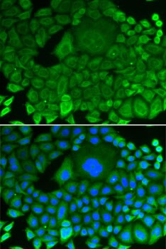 RhoGDI Antibody - BSA Free