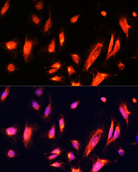 ARL4 Antibody - Azide and BSA Free