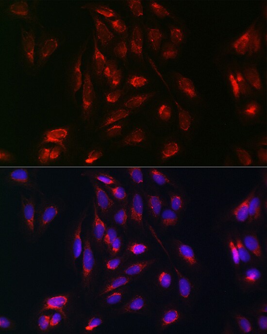 Rab5a Antibody - Azide and BSA Free