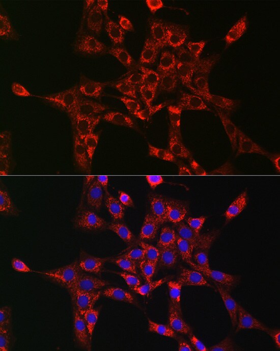 Rab5a Antibody - Azide and BSA Free
