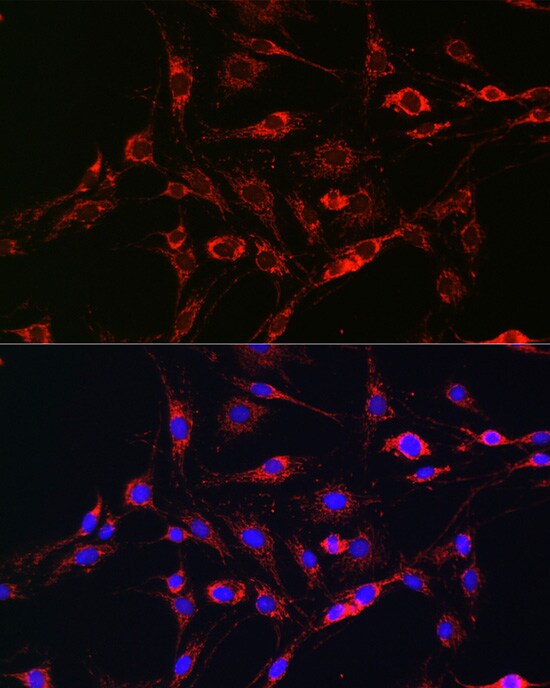 Rab5a Antibody - Azide and BSA Free