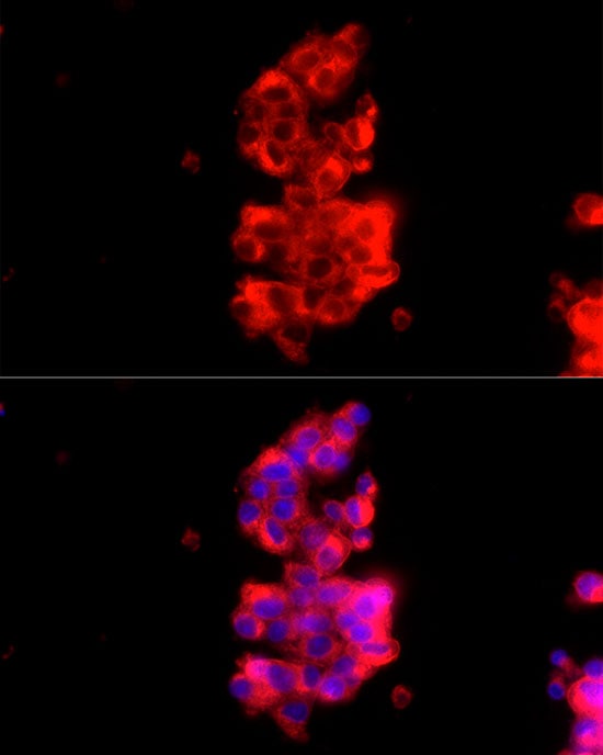 Rab27a Antibody - BSA Free