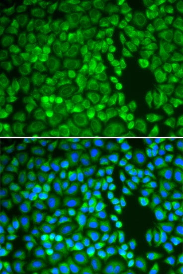 Insulysin/IDE Antibody - BSA Free