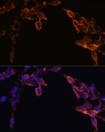 POR/Cytochrome P450 Reductase Antibody - BSA Free