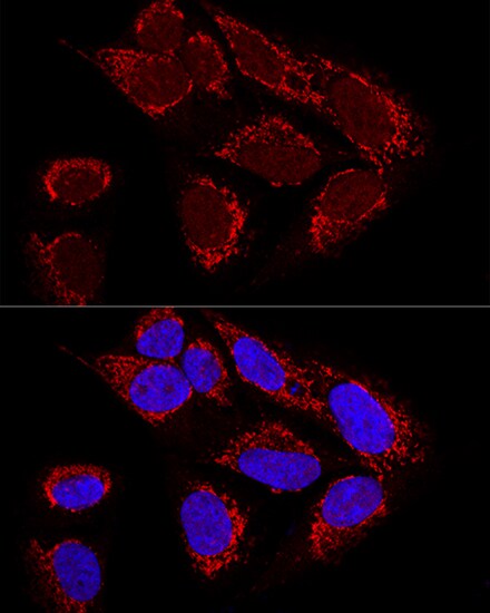 Metaxin-2 Antibody - BSA Free