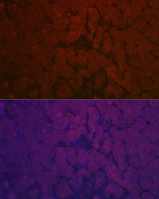 Nicotinamide N-Methyltransferase/NNMT Antibody - Azide and BSA Free