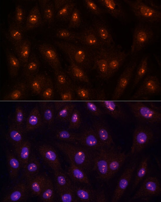 Protein Phosphatase 1C gamma Antibody - BSA Free