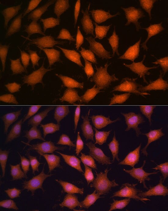 Protein Phosphatase 1C gamma Antibody - BSA Free