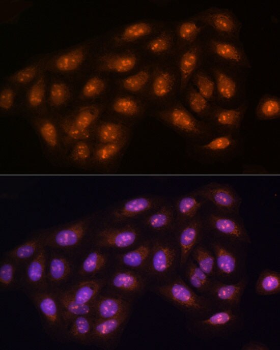 Protein Phosphatase 1C gamma Antibody - BSA Free