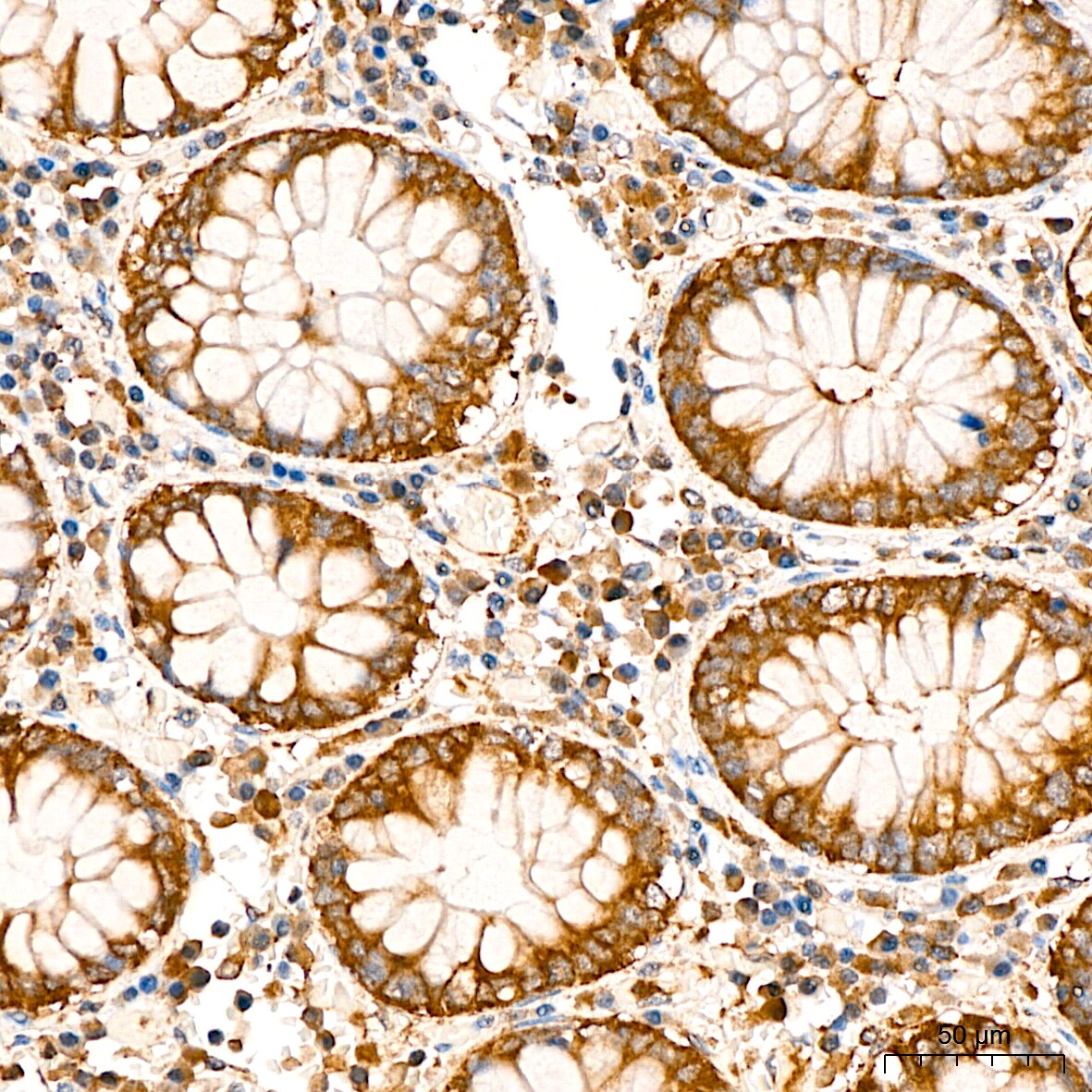 Lactate Dehydrogenase B Antibody - BSA Free