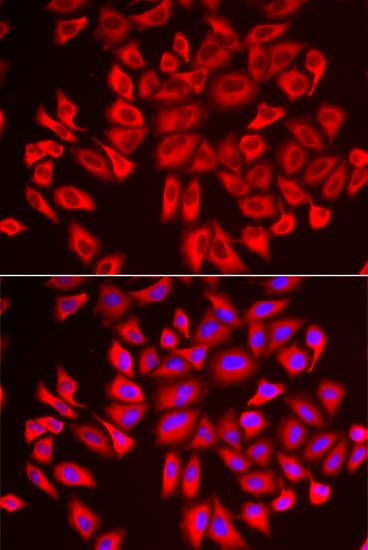 WDR68 Antibody - BSA Free