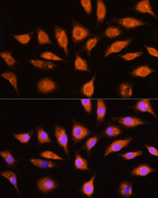 GNAI3 Antibody - BSA Free