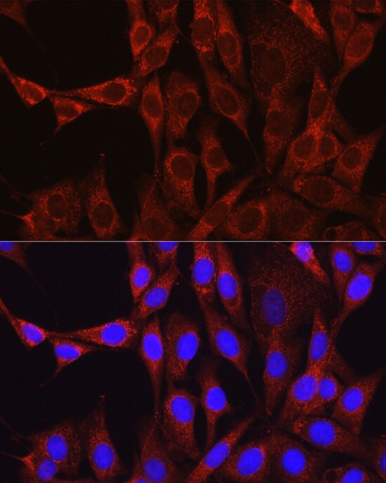 Glutamine Synthetase Antibody - BSA Free