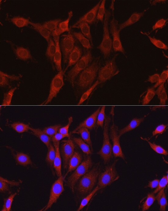 Glutamine Synthetase Antibody - BSA Free