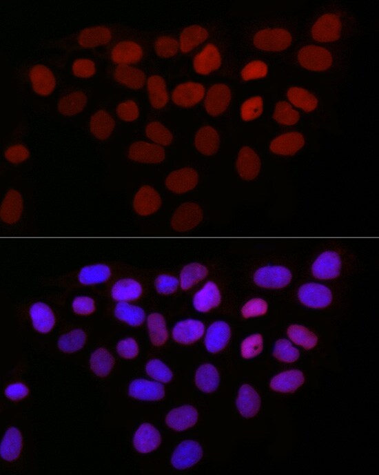 Thymopoietin/LAP2 Antibody - Azide and BSA Free