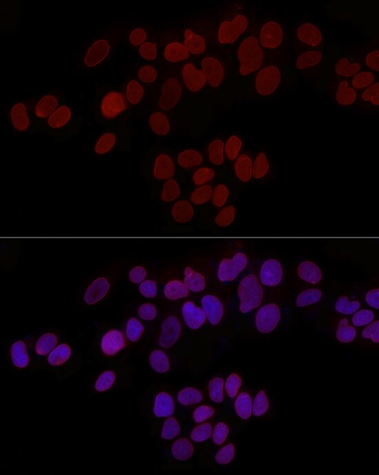 Thymopoietin/LAP2 Antibody - Azide and BSA Free
