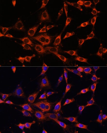 IP3R3 Antibody - Azide and BSA Free