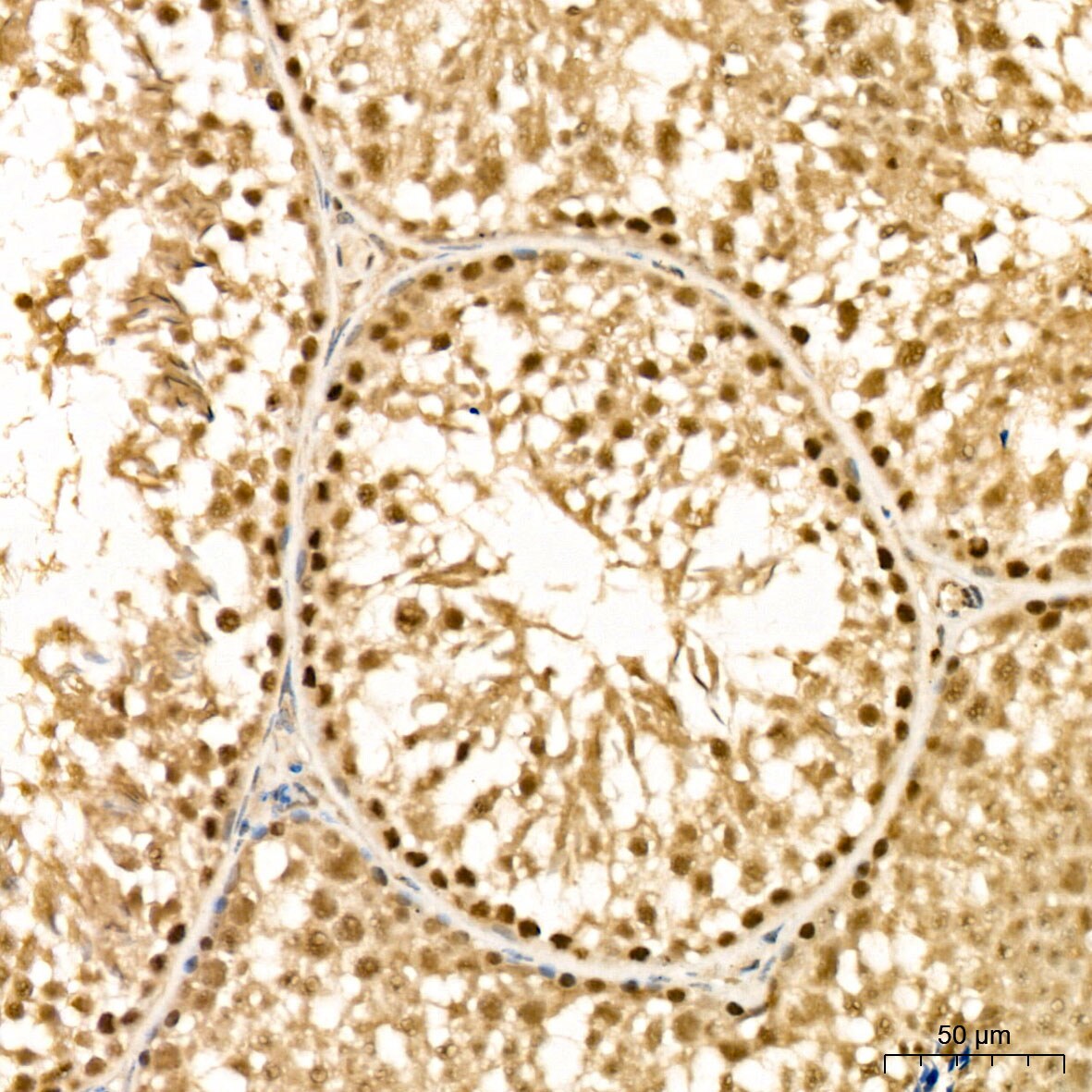 Methionine Sulfoxide Reductase B Antibody - BSA Free
