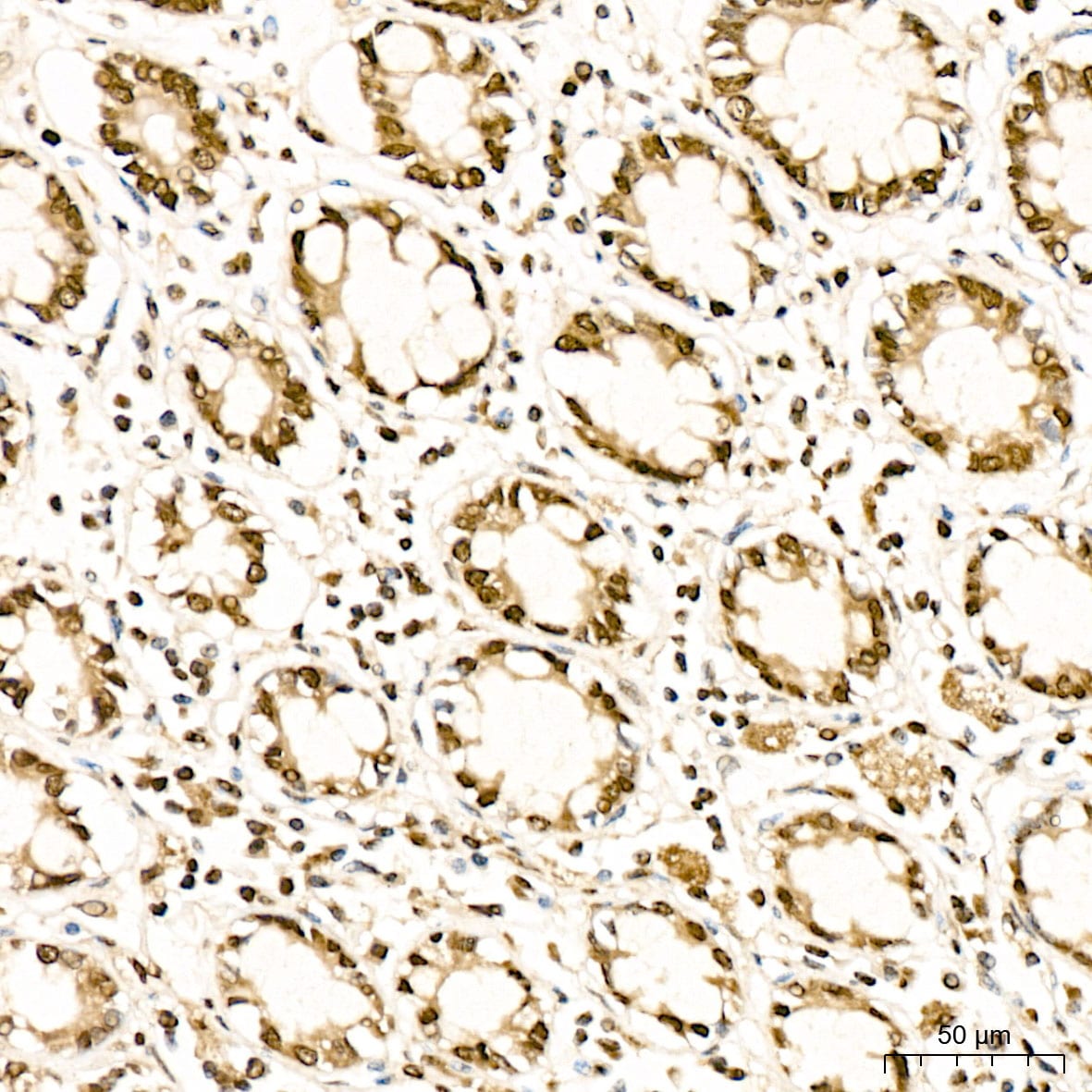 Methionine Sulfoxide Reductase B Antibody - BSA Free
