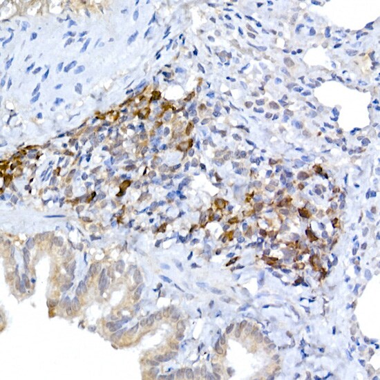 MLL5 Antibody - Azide and BSA Free