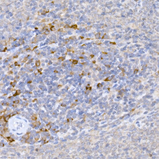 MLL5 Antibody - Azide and BSA Free